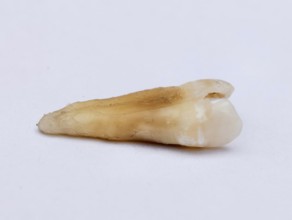 Pulled out cracked and damaged tooth, second premolar on a white background. Karaganda, Kazakhstan