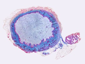 Micrograph showing the urinary bladder from a rat
