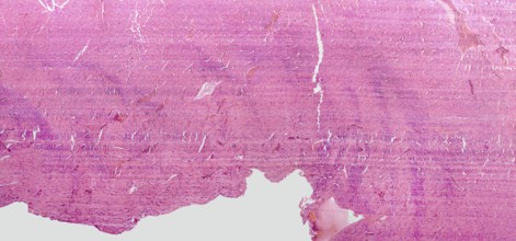 Microscopic detail showing a rats heart detail