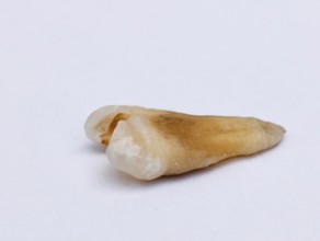 Pulled out cracked and damaged tooth, second premolar on a white background. Karaganda, Kazakhstan