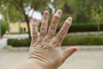 Close-up of wrinkled hand demonstrating osteoarthritis symptoms, highlighting age-related joint