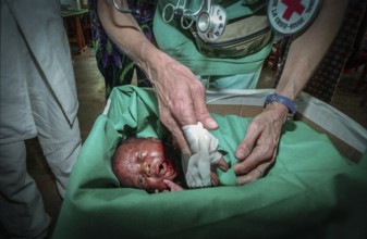 RWA Rwanda Kigali An injured Tutsi refugee child is receiving medical care in a makeshift hospital