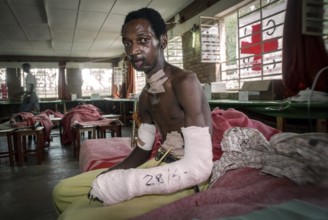 RWA Rwanda Kigali Injured Tutsi refugee receives medical care in a makeshift hospital by doctors