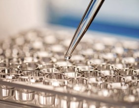 Reflective wells shimmer as a pipette releases a precise droplet, Pipette dispensing a liquid onto