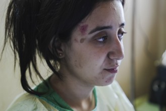 Wounded individuals receiving treatment at a hospital after being evacuated with difficulty from