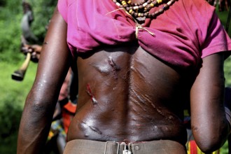 Hamer ritual with scars as part of the initiation process, Turmi, Ethiopia