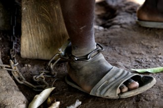 Close-up of foot in chains as a symbol of mental illness, Brobo, Ivory Coast