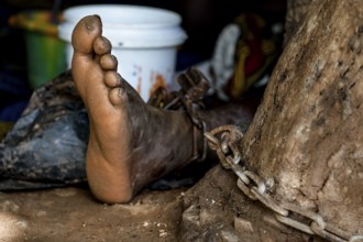 A foot in chains on barren soil shows the fate of mentally ill people, Brobo, Ivory Coast