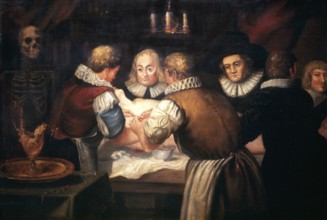 Ärzte, Chirurgen bei einer Operation an der Brust einer Frau im 17. Jahrhundert. Ölgemälde, das