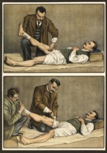 First aid, broken leg is tied off by two helpers, school picture, authentic reproduction of a