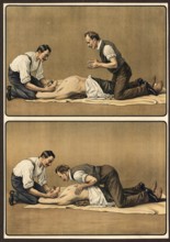 First aid, depiction of artificial respiration by two helpers, school picture, authentic