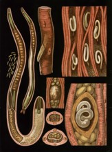 Scientific illustration with details, nematode, trichinella spiralis, school picture, authentic