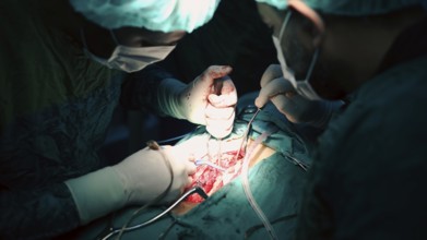 Several doctors performing a complex surgical operation inside an operating room for a displaced