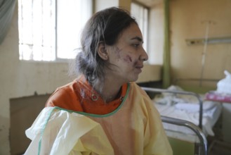 Wounded individuals receiving treatment at a hospital after being evacuated with difficulty from
