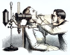 Historical illustration of the medication of a larynx, viewing with light, medicine/Historical