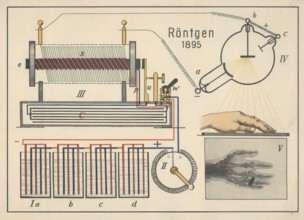The illustration shows the first X-ray image of a human hand, which was taken by Wilhelm Conrad