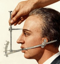 Median facial goniometer of Pierre Paul Broca, 1824 – 1880, French physician, anatomist and