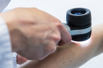 Dermatological examination with dermatoscope on a forearm, Düsseldorf, Germany