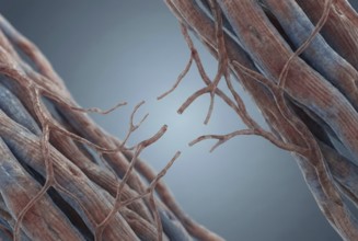 Microscopic view of the fine capillaries of the heart muscle showing the loss of small blood