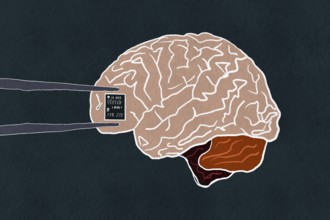 An illustration depicting a human brain with tweezers installing a microchip This concept