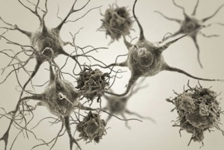 Macro-cross section of degenerating nerve cells with visible protein deposits to visualize