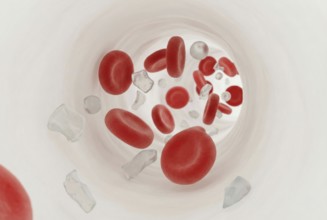 Macro illustration of microplastic particles between red blood cells in human blood, AI generated