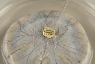 Realistic illustration of a neural implant in contact with nerve cells, AI generated