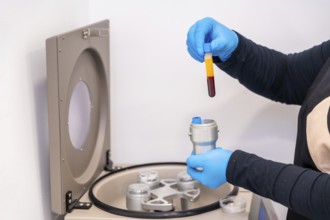 Close-up side view of a technician using blood centrifuge machine for an innovative baldness
