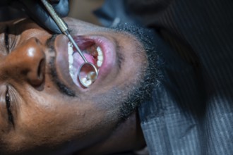 Dentist wearing black gloves using a dental mirror to examine patient's teeth during a checkup at a