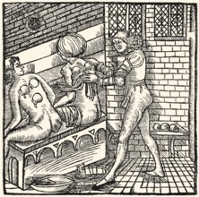 Cupping therapy, woodcut, 1519, Therapieverfahren mit Schröpfköpfen, Holzschnitt, 1519