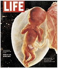 First picture of a human foetus in the press