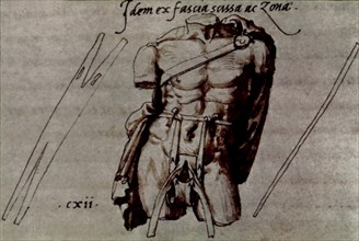 Drawing of bandages attributed to Il Primaticcio
