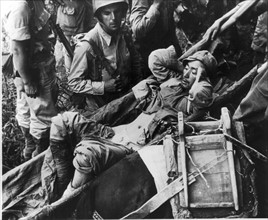 Soldats chinois blessés pendant les combats dans le Sud-Ouest de la Chine, 1944