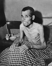 An emaciated slave laborer at Seesen (Germany) May 6, 1945.