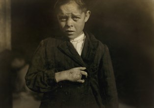 Giles Edmund Newsom, Young Cotton Mill Worker, 12 years old, Fell on to Spinning Machine and his hand went to into unprotected gearing, losing two fingers, Half-length Portrait, Sanders Spinning Mill,...