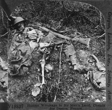 Human Skeleton Remains of Soldier, World War I, Chenin des Dames, France