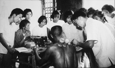 Doctor Performing Acupuncture and Utilizing Bamboo Suction Tubes while Students Watch, Malu People's Commune, Shanghai, China, 1965