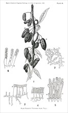 Plum Pockets, Taphrina Pruni, Tul., Report of the Commissioner of Agriculture, US Dept of Agriculture, Illustration,  1888