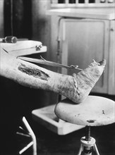 Leg Wound at Unidentified Base Hospital during World War I, France,