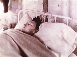 Wounded Man at  unidentified Base Hospital during World War I, France,