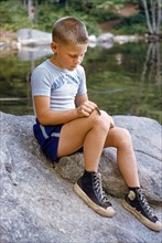 Young Boy with Small Lizard on his Knee at Summer Camp