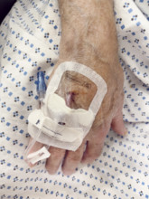 Hospital patient with IV port inserted in his hand