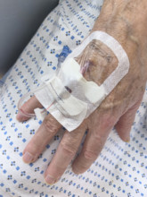 Hospital patient with IV port inserted in his hand