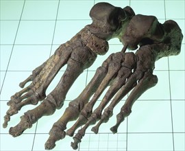 A Late Saxon/Norman woman's skeletal feet, 11th-12th century. Artist: Unknown
