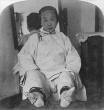 'A high caste lady's dainty 'lily feet', showing method of deformity', China, 1900.  Artist: Underwood & Underwood