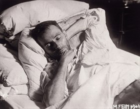 Egon Schiele on his Deathbed, 1918. Creator: Fein, Martha