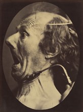 Figure 63: Expression of terror, 1854-56, printed 1862.