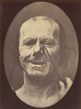 Figure 53: Whimpering and false laughter, 1854-56, printed 1862.