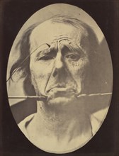 Figure 45: Pain and despair. , 1854-56, printed 1862.