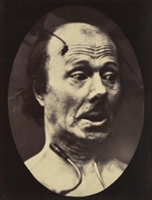 Figure 60: Fright, 1854-56, printed 1862.